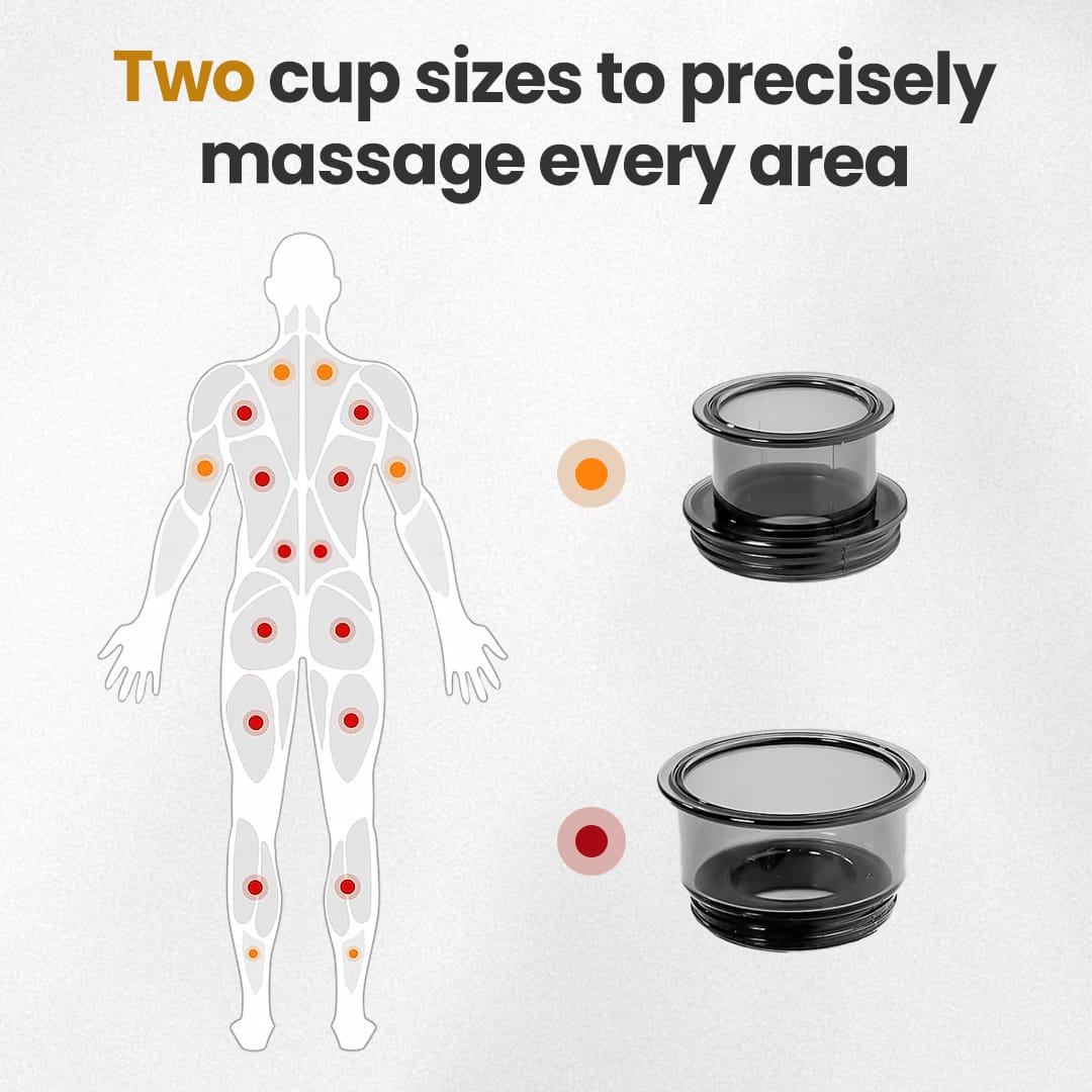 kit cupping