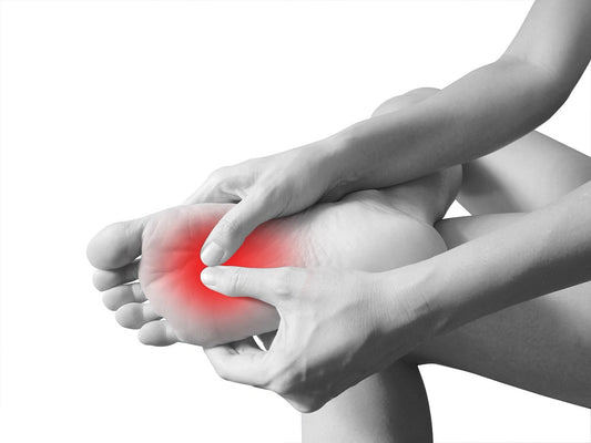 How to Treat Plantar Fasciitis: A Comprehensive Guide